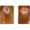 Восстановление волос после наращивания